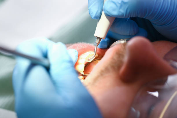 Best Pediatric Emergency Dentist in Shady Hollow, TX