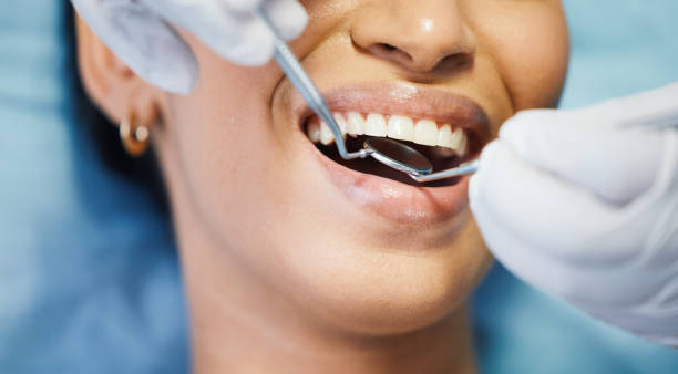 Best Emergency Treatment for Toothache in Shady Hollow, TX